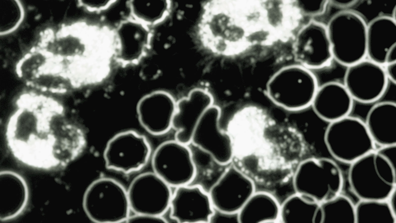 Vitalblut - Dunkelfeldmikroskopie